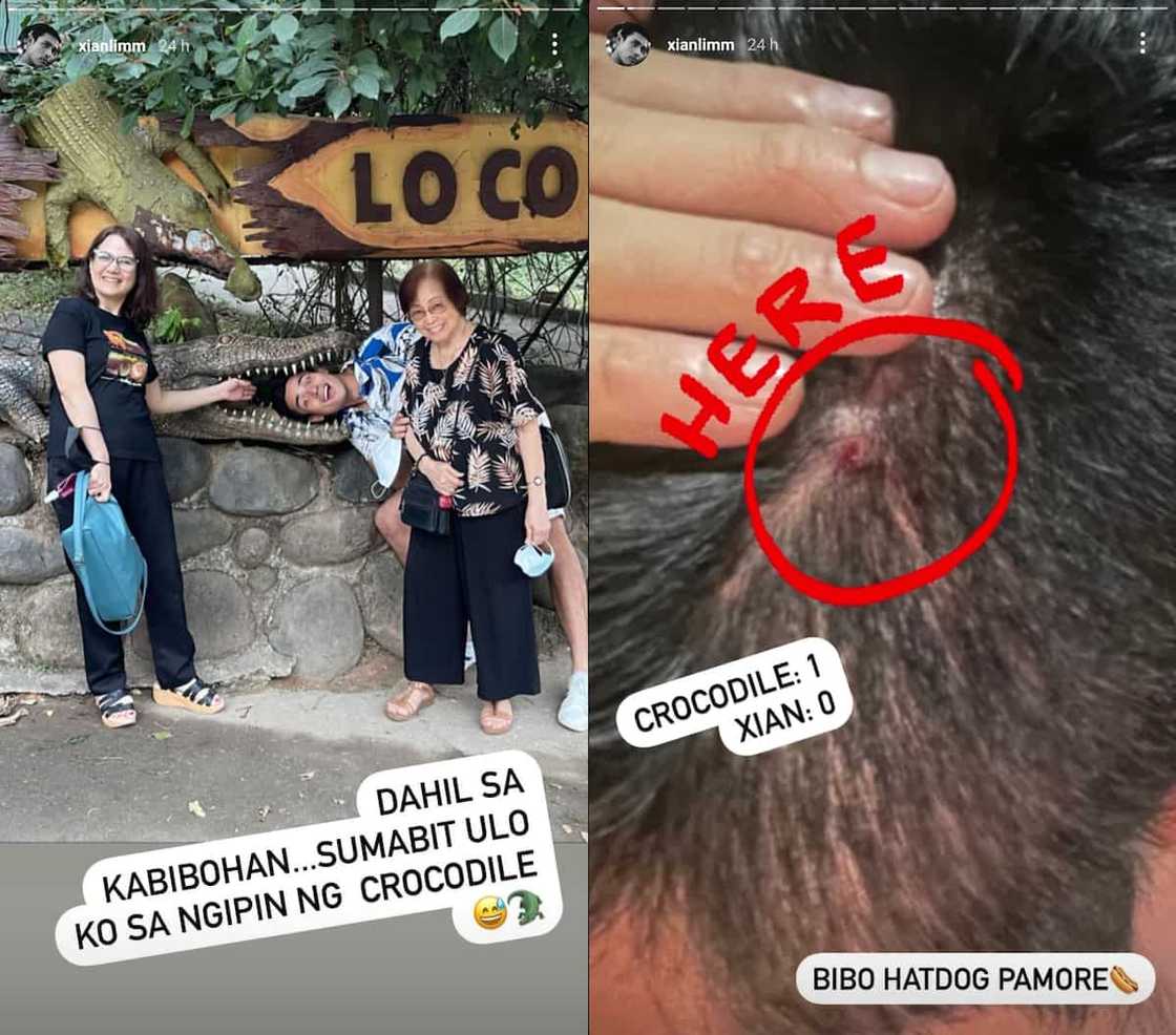 Xian Lim, nasugatan matapos sumabit ang ulo sa nakakatawang crocodile picture Xian Lim, nasugatan matapos sumabit ang ulo sa nakakatawang crocodile picture