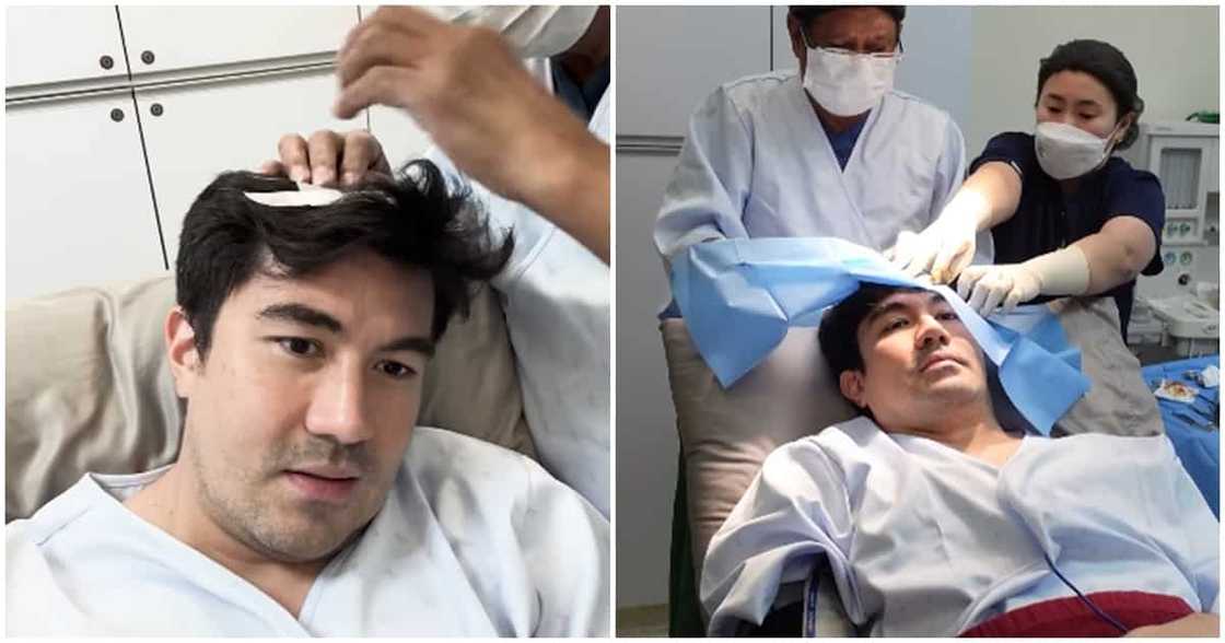 Luis Manzano, kinailangan magpa-biopsy: "Akala ko dati pa, nunal"