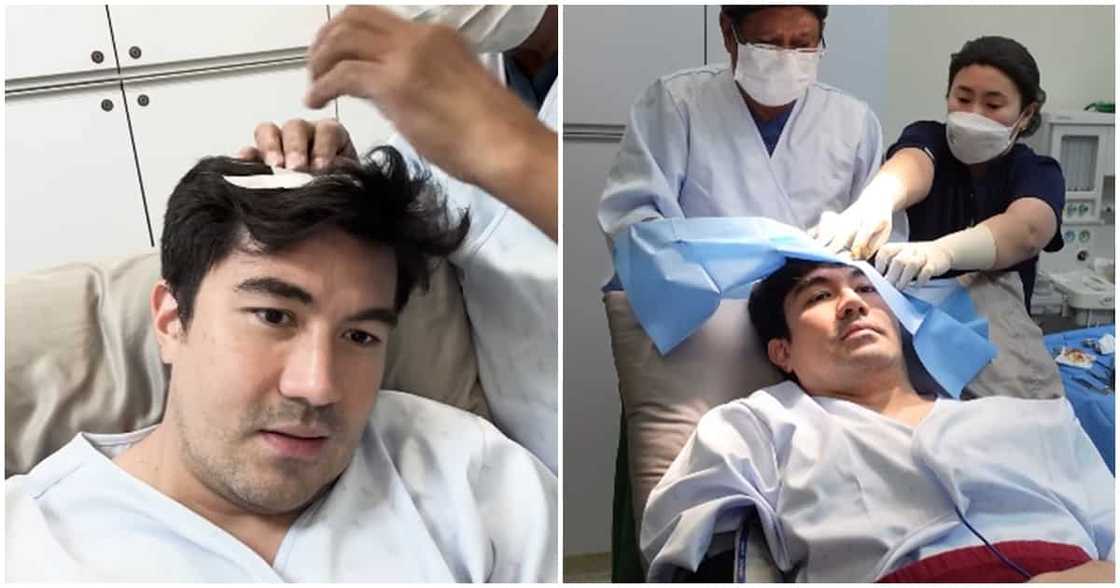 Luis Manzano, kinailangan magpa-biopsy: "Akala ko dati pa, nunal" Luis Manzano, kinailangan magpa-biopsy: "Akala ko dati pa, nunal"