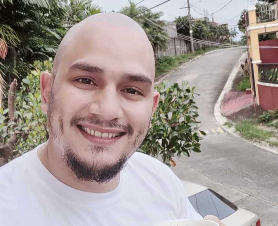 Kiko Matos: "Di bale ng walang buhok basta may FB"