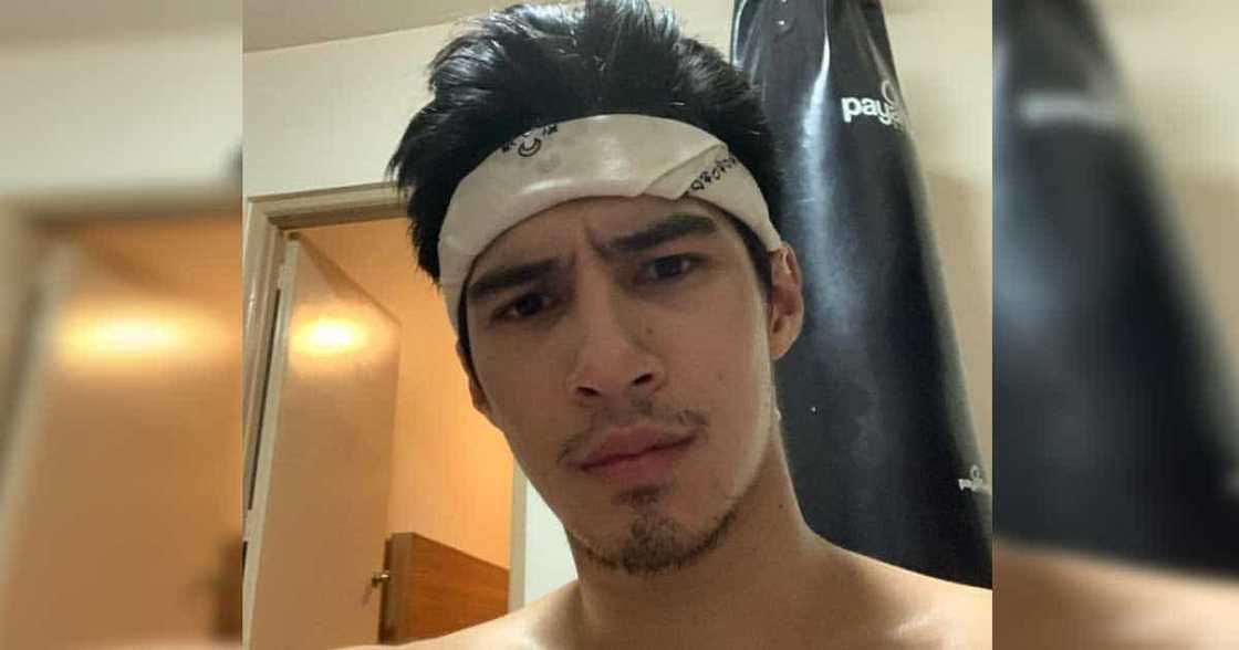 Albie Casiño declares he's not mad at government after viral "congrats to to those who voted in 2016" Albie Casiño declares he's not mad at government after viral "congrats to to those who voted in 2016"