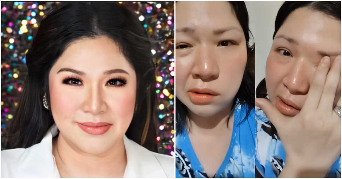 Frenchie Dy, emosyonal na binahagi ang tungkol sa kanyang ikatlong Bell's Palsy attack