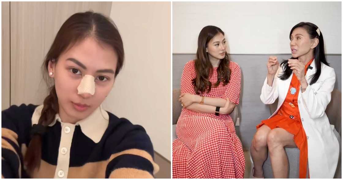 Vicki Belo, may nilinaw sa pagpapatanggal ni Alex Gonzaga sa kanyang nose implant Vicki Belo, may nilinaw sa pagpapatanggal ni Alex Gonzaga sa kanyang nose implant