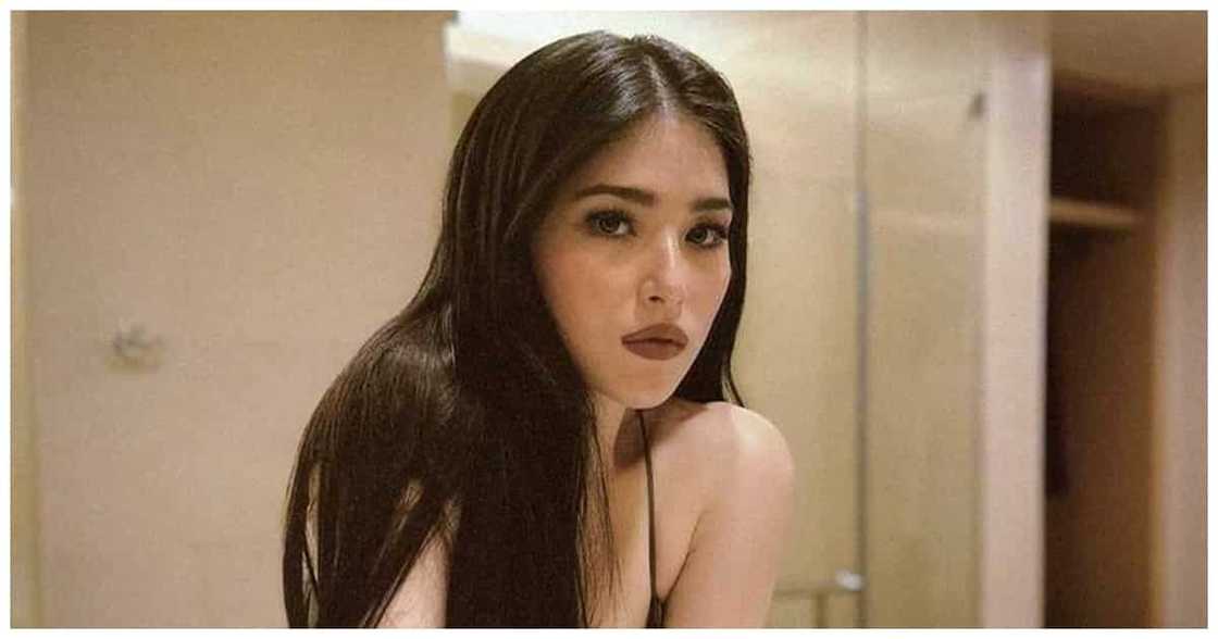 Kylie Padilla pens a message on social media: "It took a year to shed that scar"
