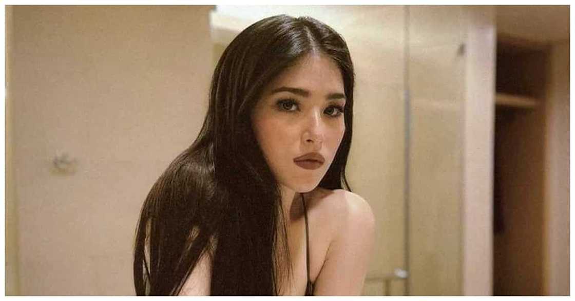 Kylie Padilla pens a message on social media: "It took a year to shed that scar" Kylie Padilla pens a message on social media: "It took a year to shed that scar"