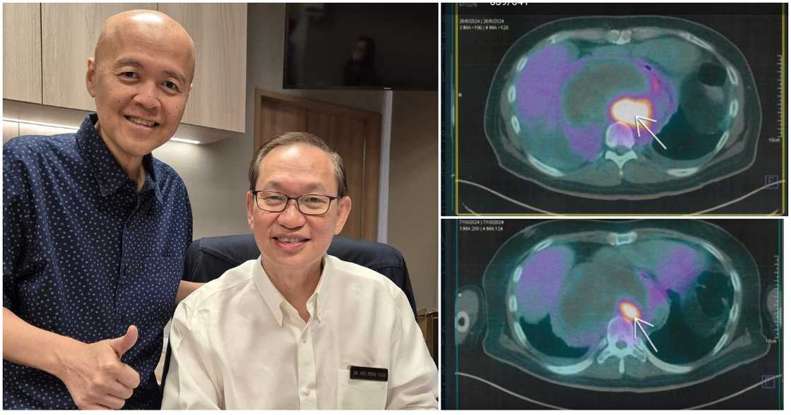 Doc Willie Ong, binahagi ang resulta ng kanyang PET scan