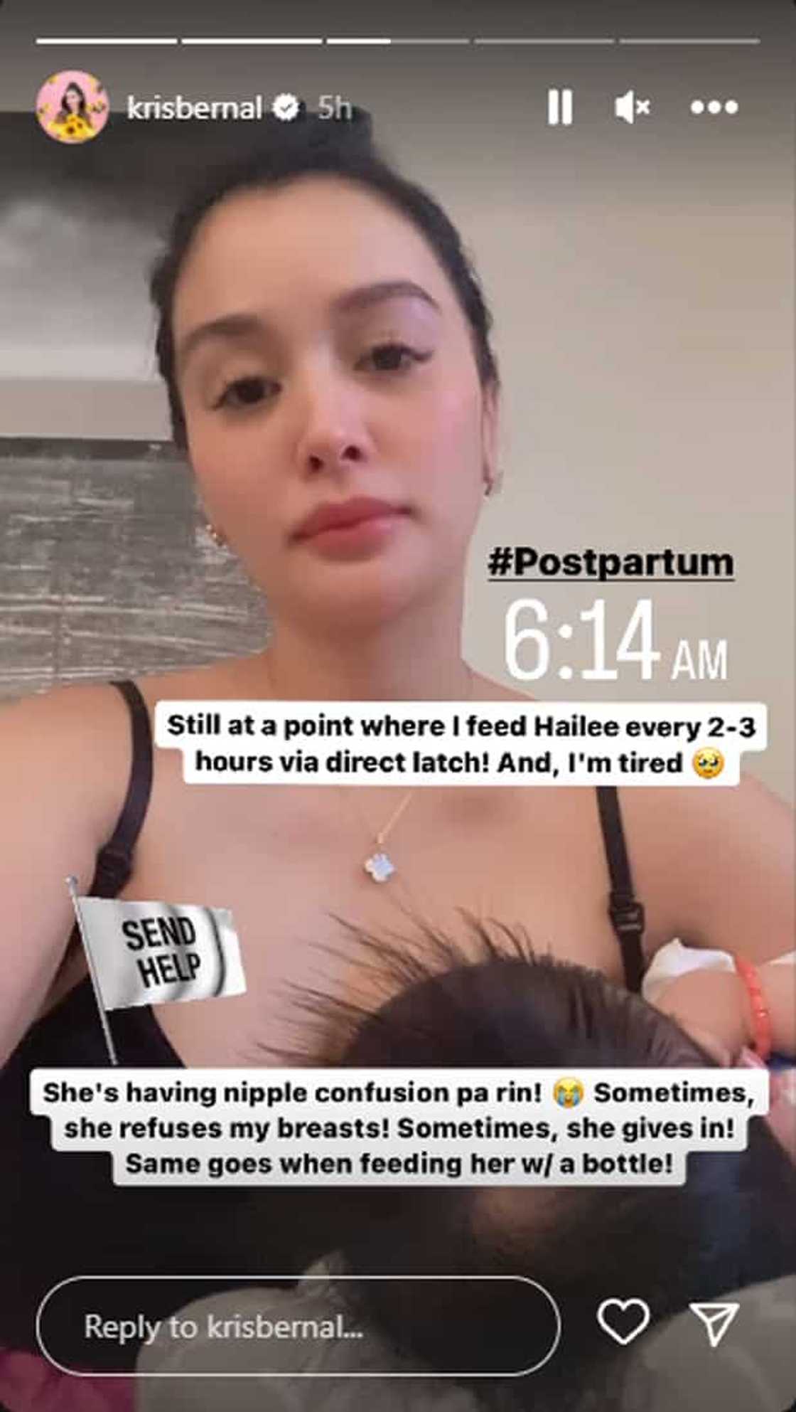 Kris Bernal Kris Bernal