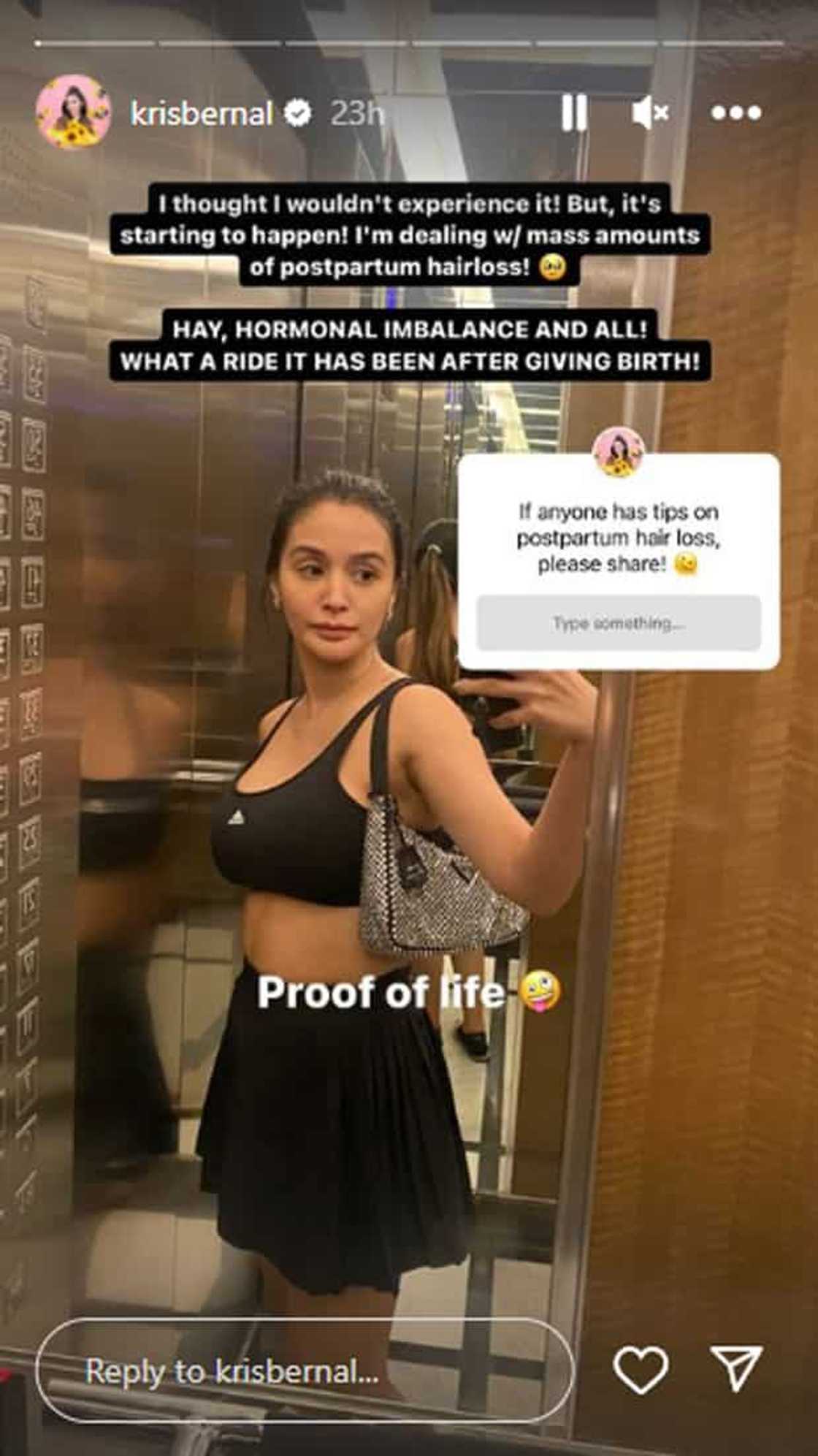 Kris Bernal Kris Bernal