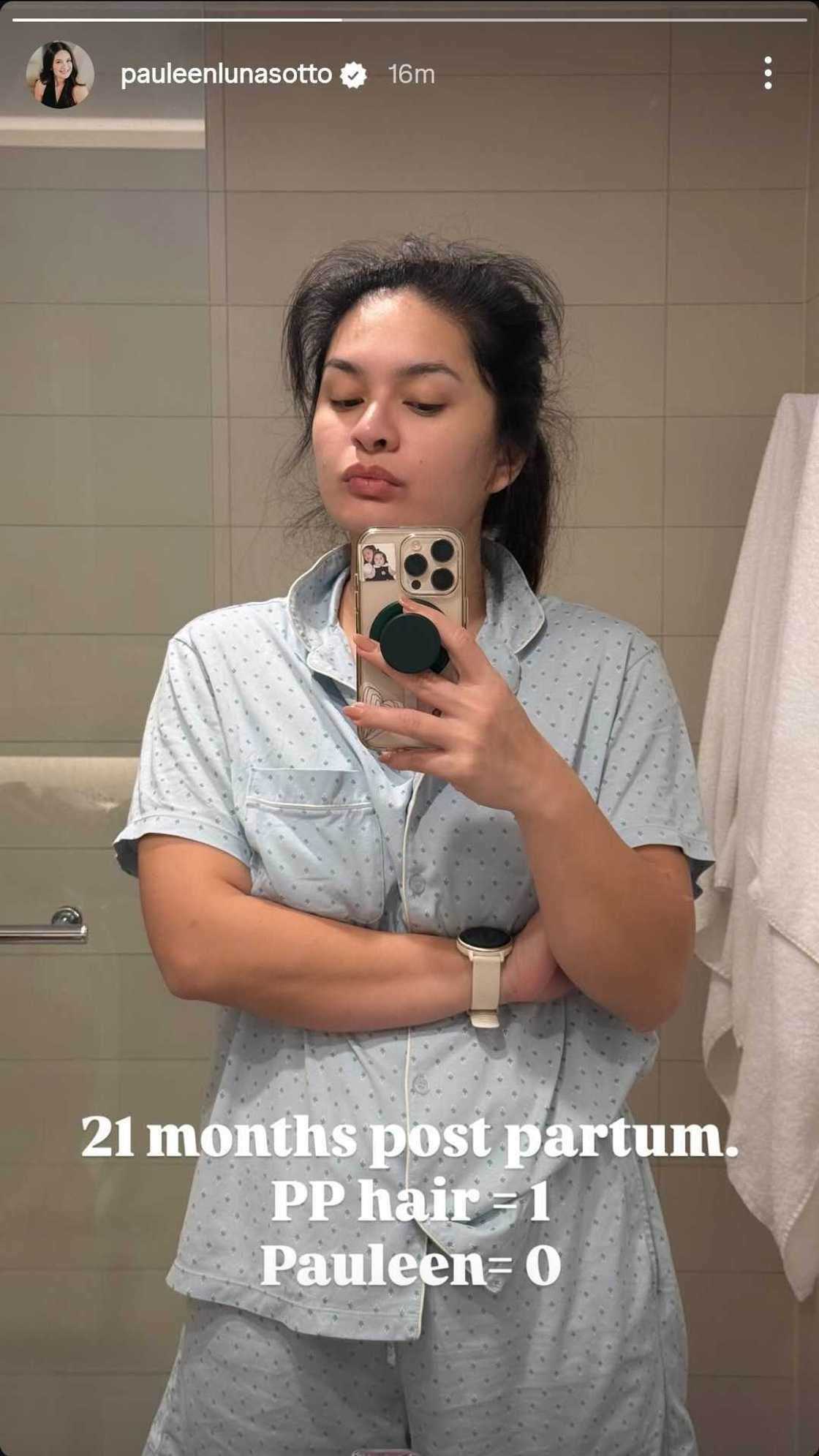 Pauleen Luna candidly shares her postpartum hair struggles in latest selfie post