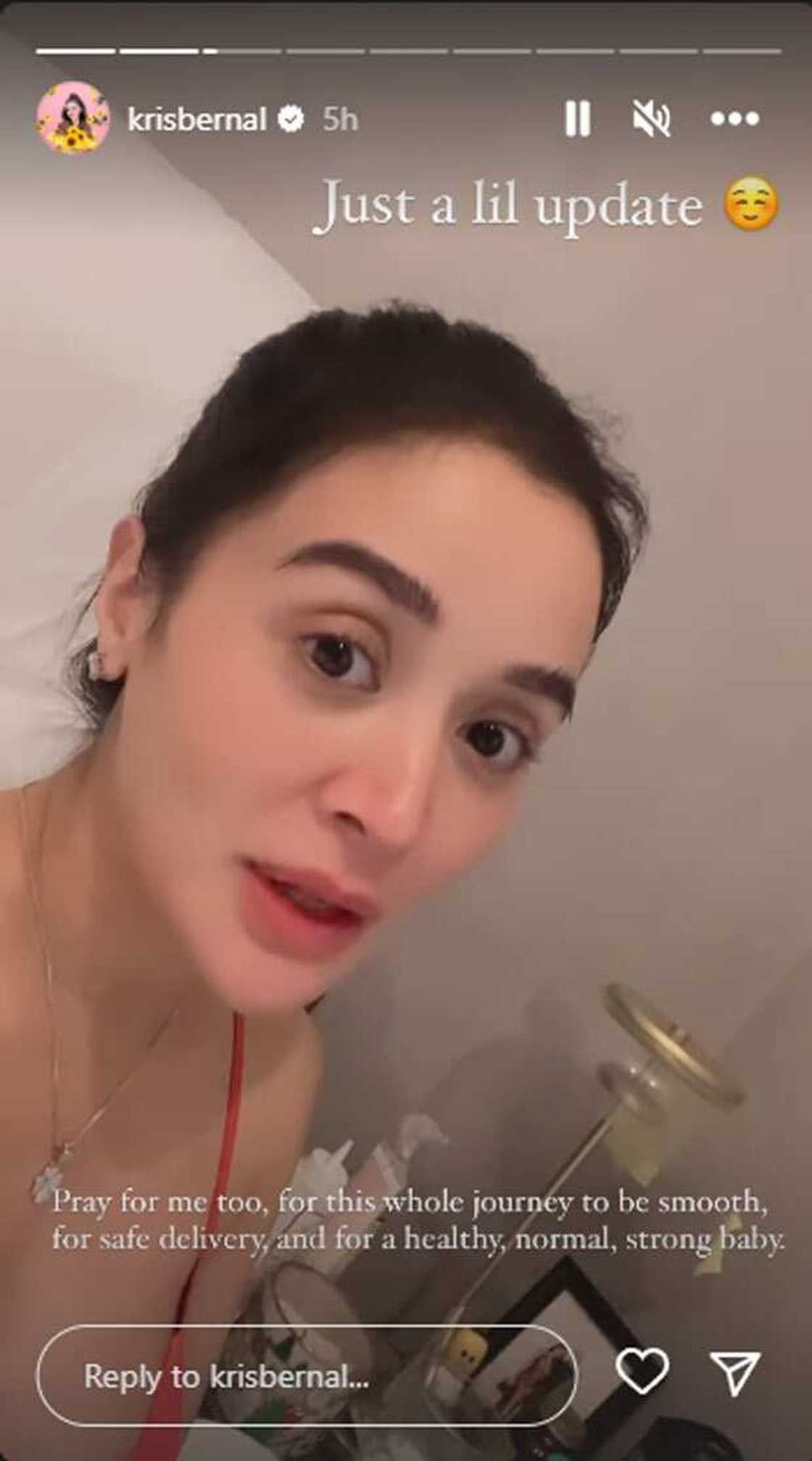 Kris Bernal