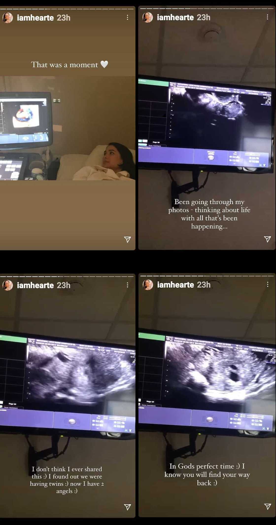 Heart Evangelista recollects pregnancy; shares ultrasound videos of her “2 angels” Heart Evangelista recollects pregnancy; shares ultrasound videos of her “2 angels”