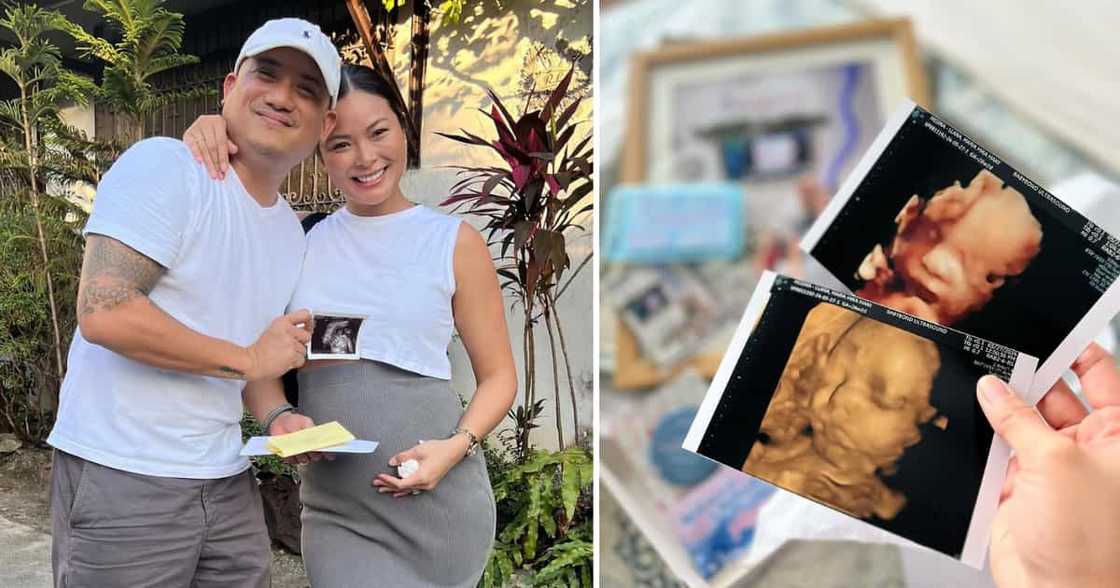 Maxine Medina shares sonogram of her baby: "can't wait to meet you in person"