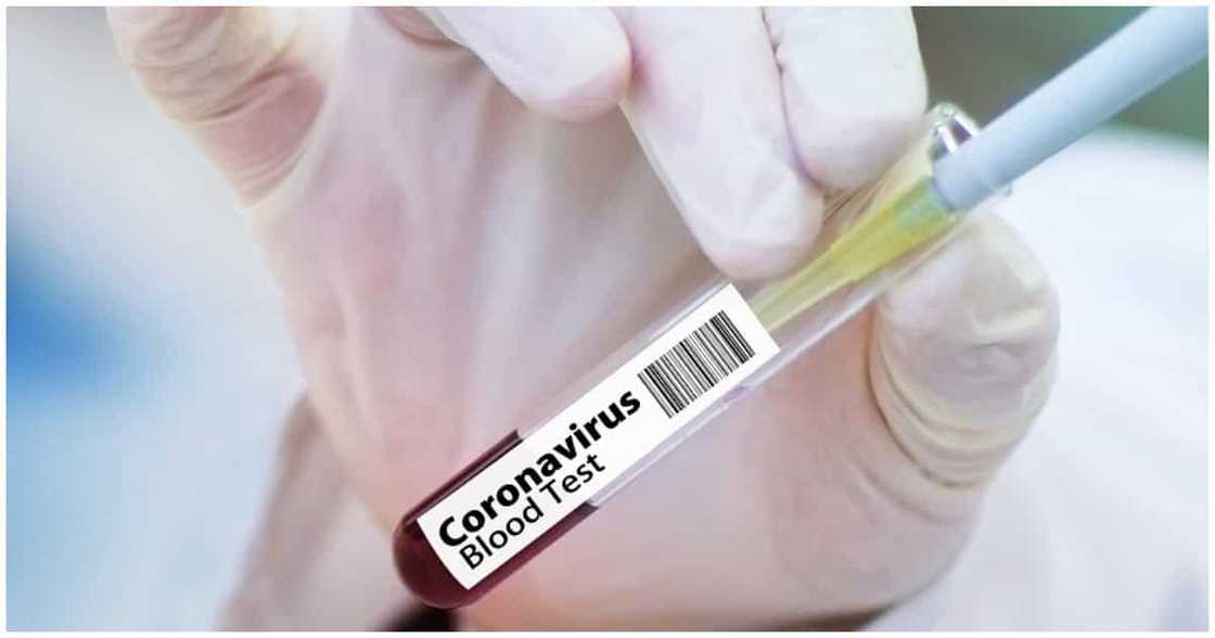 'Wag magpuyat! Lack of sleep linked to higher COVID-19 risk 'Wag magpuyat! Lack of sleep linked to higher COVID-19 risk