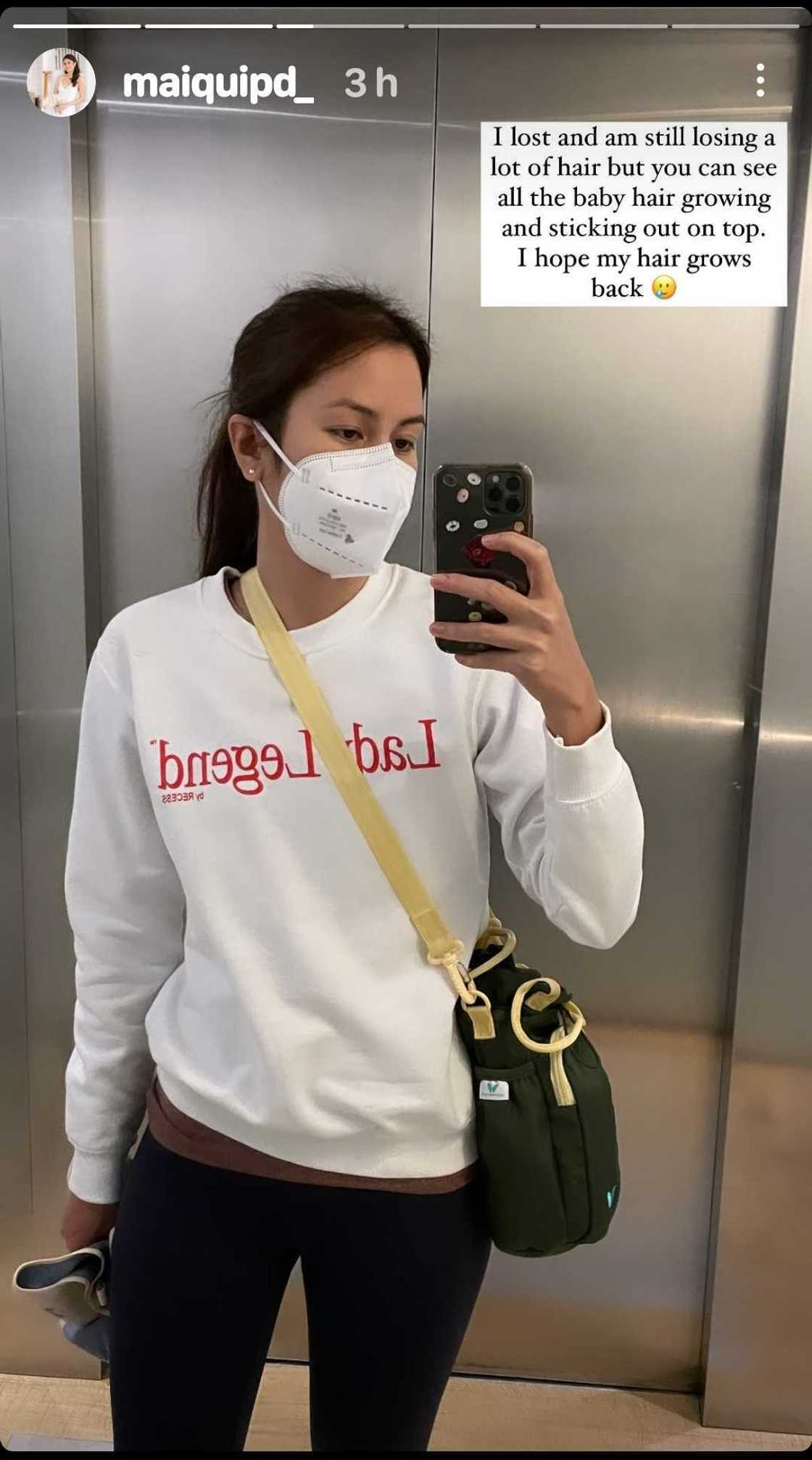 Robi Domingo’s wife Maiqui Pineda flaunts baby hair: “I hope my hair grows back” Robi Domingo’s wife Maiqui Pineda flaunts baby hair: “I hope my hair grows back”