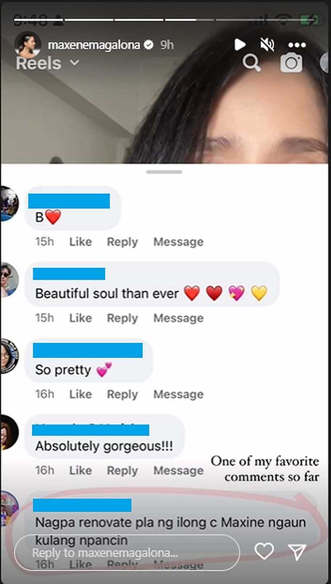 Maxene Magalona sa nagsabing nagpa-renovate siya ng ilong: "One of my favorite comments" Maxene Magalona sa nagsabing nagpa-renovate siya ng ilong: "One of my favorite comments"