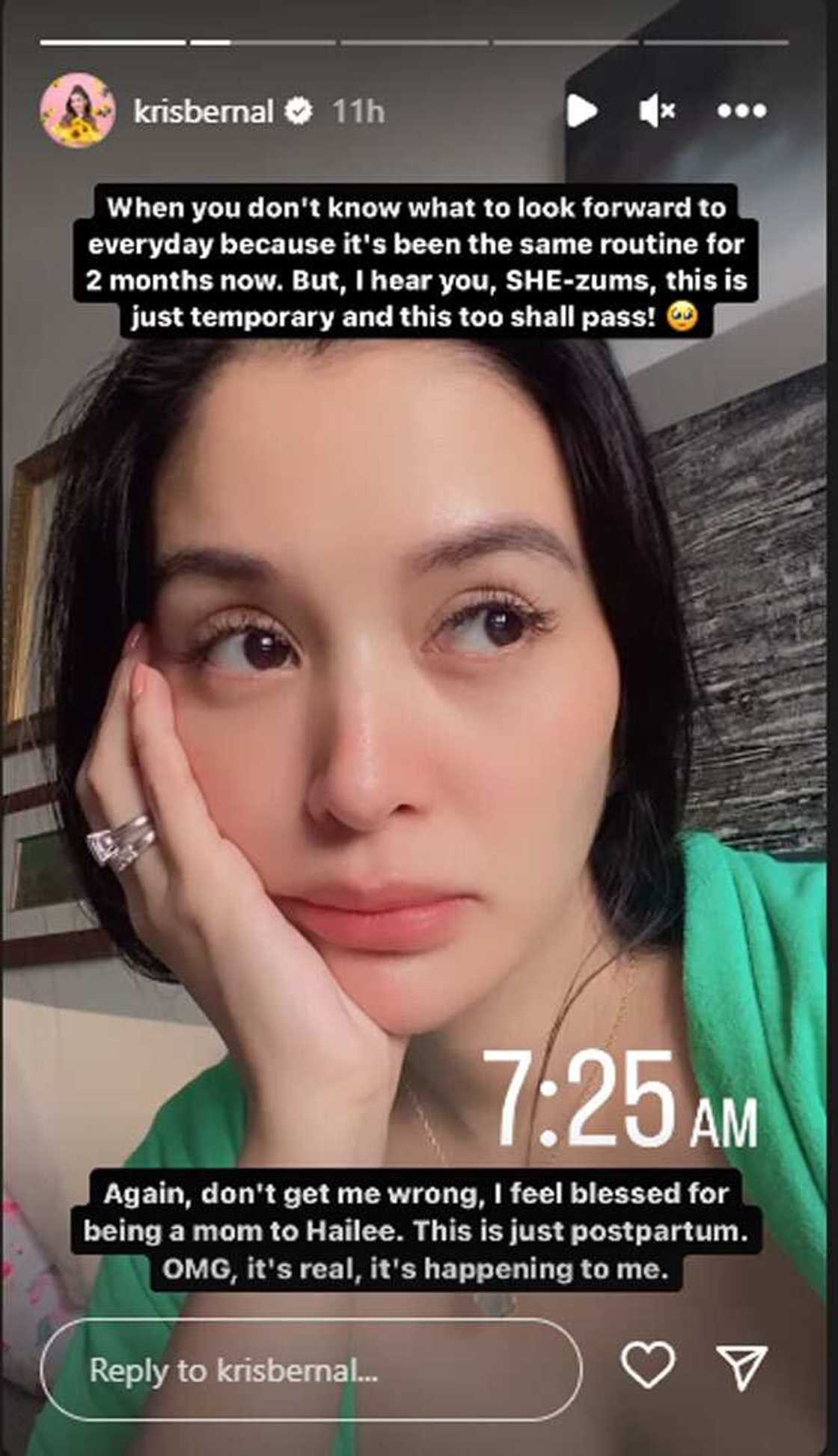 Kris Bernal Kris Bernal
