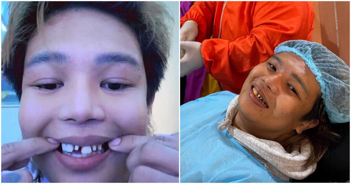 Xander Arizala, nagbahagi ng update sa kanyang dental treatment Xander Arizala, nagbahagi ng update sa kanyang dental treatment