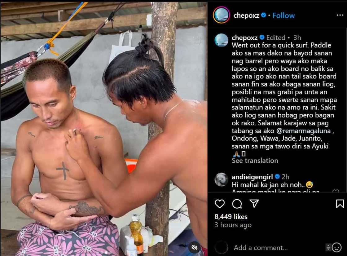 Philmar Alipayo, ibinahagi buwis-buhay na karanasan sa surfing: “Tinamaan ako ng tail ng board ko” Philmar Alipayo, ibinahagi buwis-buhay na karanasan sa surfing: “Tinamaan ako ng tail ng board ko”