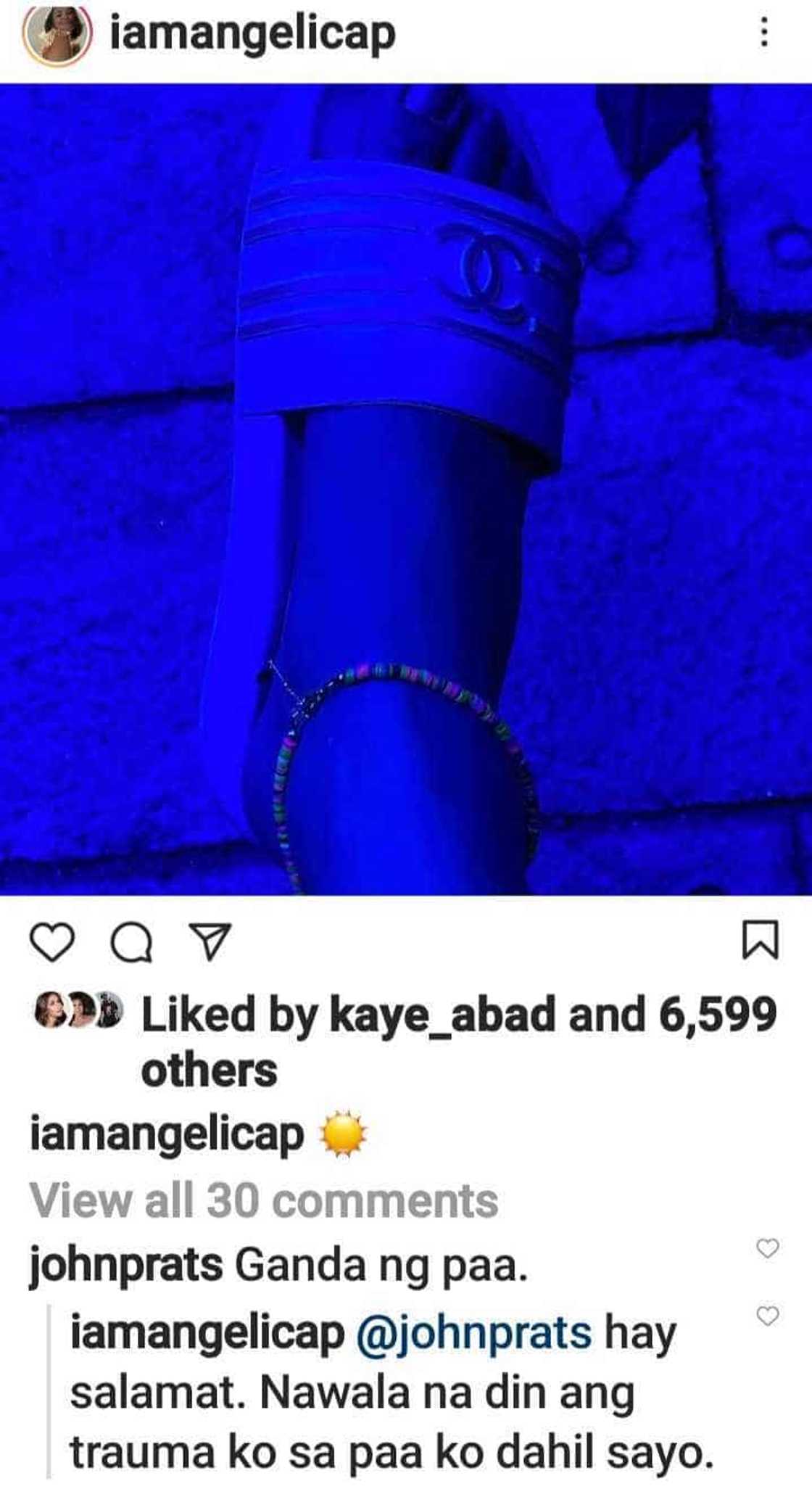 Angelica Panganiban, sinabing may trauma siya sa sarili niyang paa Angelica Panganiban, sinabing may trauma siya sa sarili niyang paa