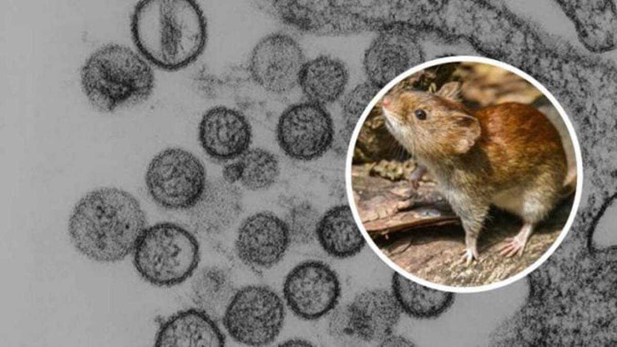 Hantavirus: meaning, symptoms, prevention, treatment - KAMI.COM.PH