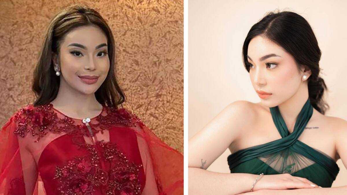 Kitty Duterte reveals getting cosmetic surgery: “Got a rhinoplasty. I ...