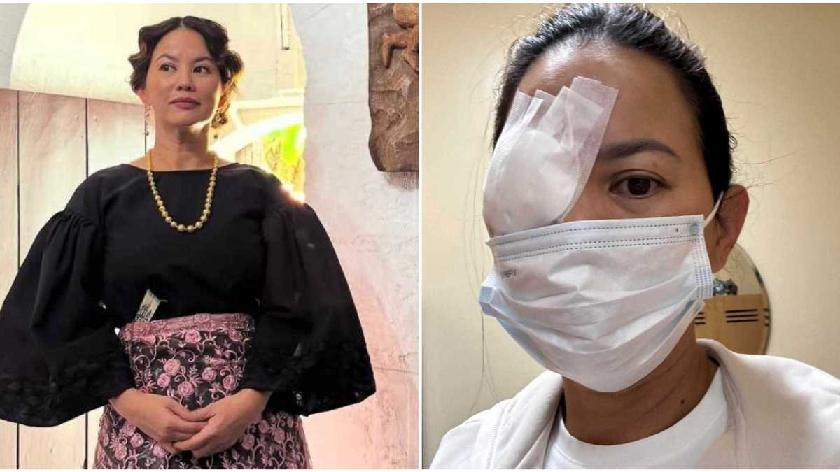 Andrea Del Rosario, kinailangan operahan sa mata: 