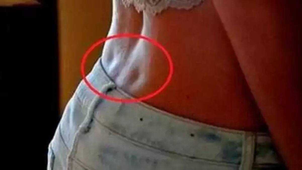 Dimpled Back Side If you have these two dimples on your lower back, we've got some good ...