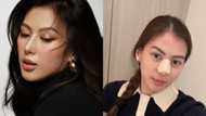Alex Gonzaga, ipinatanggal ang nose implant: “Back to normal nose na tayo”