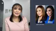 Sharon Cuneta, lalong gumanda; mga pics niya noon at ngayon ikinumpara