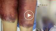 Mother seeks justice for 18-year-old daughter - abused, burned, paddled during brutal hazing