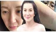 Kris Aquino, pinakita ang mga epekto at bakas ng kanyang unusual na sakit