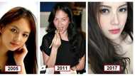 Ang laki ng pinagbago! Ellen Adarna's amazing before and after photos following alleged cosmetic enhancement