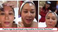 Pang-mayaman lang ‘to! Korina Sanchez finally reveals how Vicki Belo made her face thinner without plastic surgery