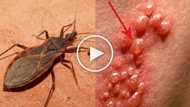 Mapanlinlang na cuteness! Lethal kissing bugs are everywhere and you probably didn't know it