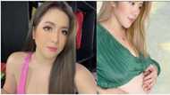 Angeline Quinto, first time ibinida ang kanyang baby bump