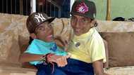 Conjoined twin influencers na sina José Armando at José Luis Cevallos, pumanaw na sa edad na 27