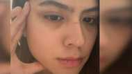 Alexa Ilacad, bongga ang resbak sa rude bashers na inakusahan siyang nagpa nose job