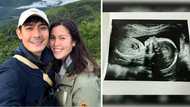 Robi Domingo, ibinahagi ang sonogram ng baby nila ni Maiqui Pineda