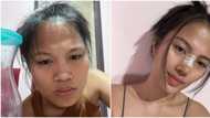 Teacher Dan, ibinida ang kanyang glow up matapos magpa-rhinoplasty