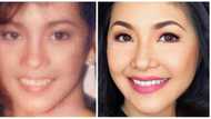 Nagsalita na! Regine Velasquez reacts to "nose job" rumors