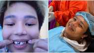 Xander Arizala, nagbahagi ng update sa kanyang dental treatment