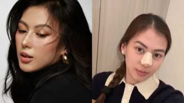 Alex Gonzaga, ipinatanggal ang nose implant: “Back to normal nose na tayo”