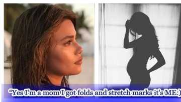 Denise Laurel tells women to embrace their stretch marks