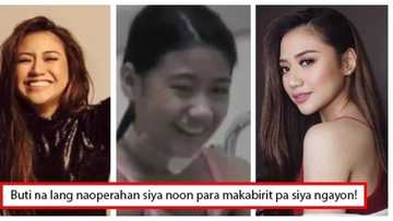 Kung sakali hindi pala siya magiging singer! Morissette Amon talks about her throat tumor when she was 11