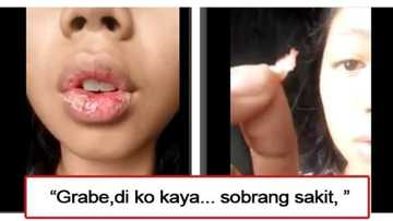 Aray... Mukhang masakit nga! Video of a girl who is allegedly addicted to lip tint goes viral