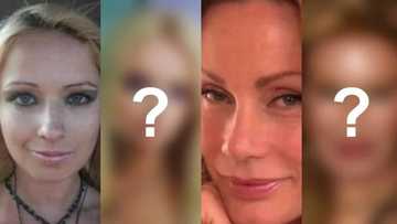 Before Shiryl Saturnino’s unfortunate incident, these 7 women had their share of failed plastic surgeries