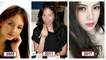Ang laki ng pinagbago! Ellen Adarna's amazing before and after photos following alleged cosmetic enhancement