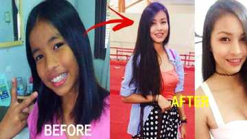 This Pinay stunned netizens with her photos before & after puberty! Check out her dramatic transformation!