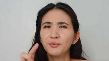 Rica Peralejo bravely opens up about undergoing plastic surgery