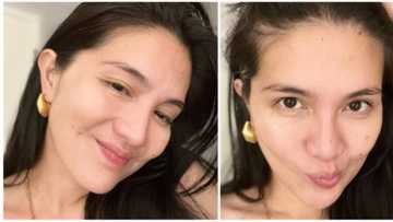 Dimples Romana captivates netizens with her no-make up selfies